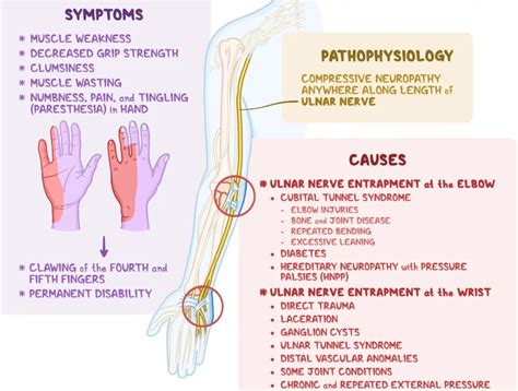 How To Fix Ulnar Nerve Entrapment | Causes & Symptoms - Gymless