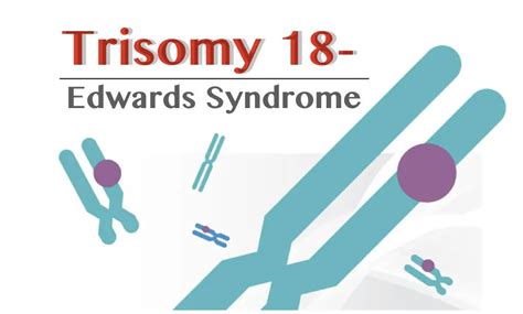 Trisomy 18 Diagram