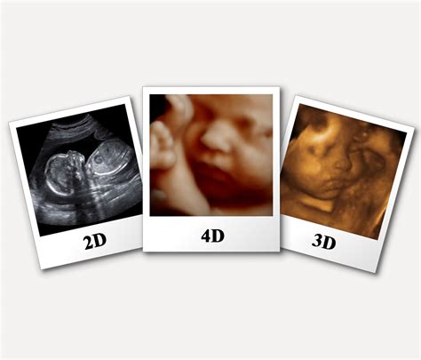 4d ultrasound pictures - westpaper