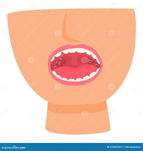 Dental Infection Icon Cartoon Vector. Mouth Hygiene Stock Vector - Illustration of human, mouth ...