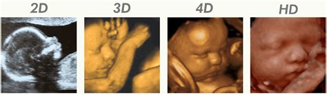 uipadmin | Mother Nurture Ultrasound