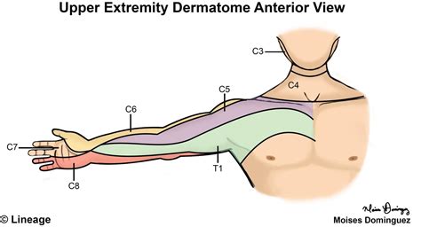 Understanding The Upper Extremity Dermatome Map: A Guide To Sensory Pathways And Clinical ...