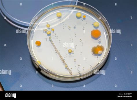 petri dish bacteria growth experiment Stock Photo, Royalty Free Image: 115237662 - Alamy