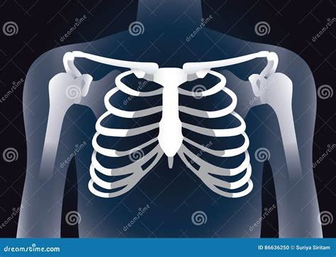 Human Rib Cage in X-ray Image Concept. Stock Vector - Illustration of body, check: 86636250