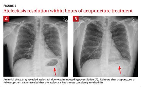 An unconventional approach to chest wall pain | MDedge Family Medicine