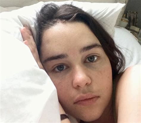 Emilia Clarke Shares Photos of Herself Post-Brain Surgery - FASHION Magazine