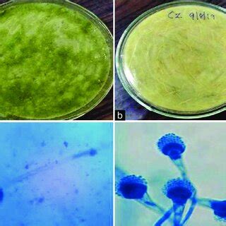 Culture and microscopic view of the Aspergillus fumigatus; (a) View of... | Download Scientific ...