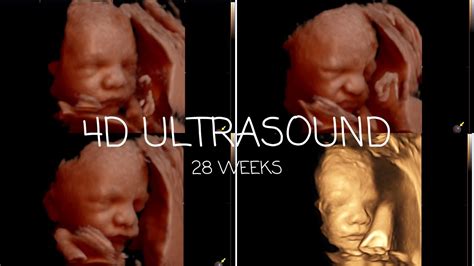 28 weeks pregnant 3d ultrasound