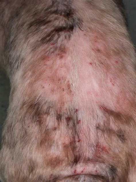 Flea Allergy Dermatitis On Humans