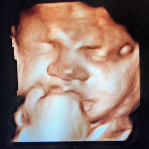 Ultrasound New Jersey - 2D, 3D, 4D Mobile Sonogram Services