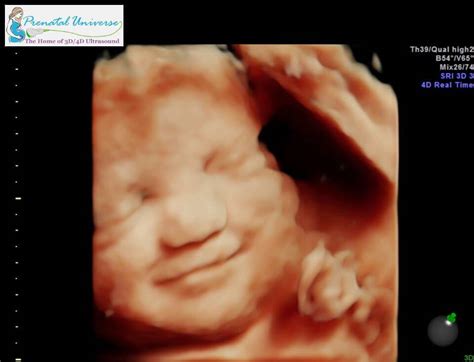 すごい 3d 4d Ultrasound - コンポート