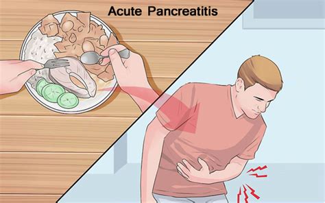 Acute Pancreatitis Symptoms-Causes-Diagnosis and Treatment