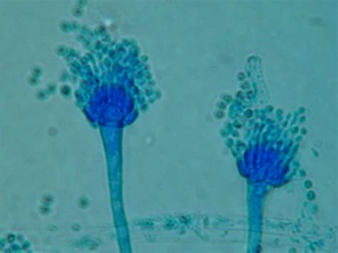 A. fumigatus Archives - Page 9 of 10 - Aspergillus and Aspergillosis