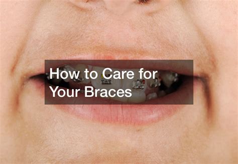 How to Care for Your Braces - Dental Hygiene Association