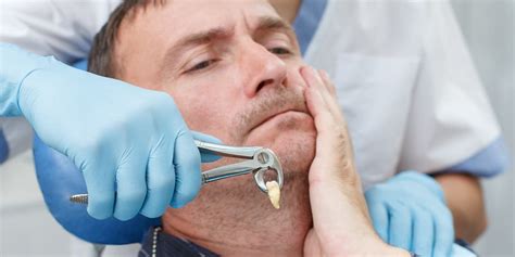 10 Best Tips To Prevent Wisdom Tooth Extraction Complications