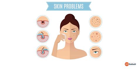 Skin Care Tips - nuevo skincare