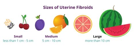 Uterus Fibroid Size Chart In Mm - Best Picture Of Chart Anyimage.Org