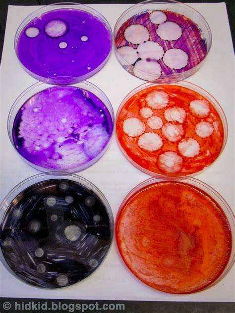 Craftimism: Petri Dish Art