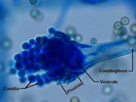 Fun With Microbiology (What's Buggin' You?): Aspergillus fumigatus