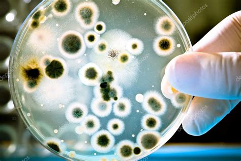 Petri Dish with Bacteria Culture Stock Photo by ©alexraths 6858095