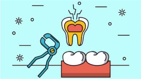 Tooth Extraction Complications | Mouthpower.org