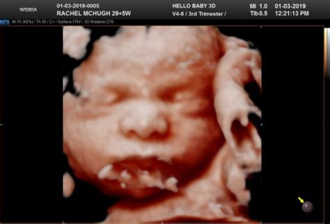 30 weeks 4d ultrasound disappointment | BabyCenter