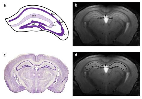 Cellular layers organization of the mouse hippocampus. a. Schematic... | Download Scientific Diagram