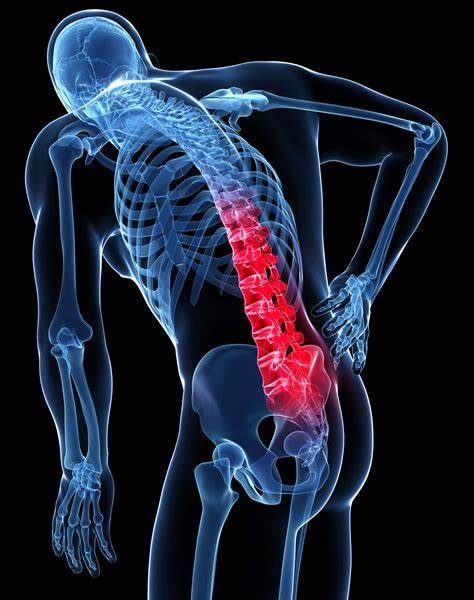 A Guide To Arthritis Back Pain – What is included in the guide!! - Genoa G8