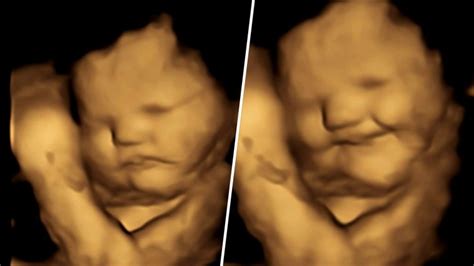 4D baby ultrasound images show fetus' possible reaction to flavors