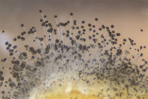 Mold Spores on Bread – Rhizopus under the microscope – Molekule Blog