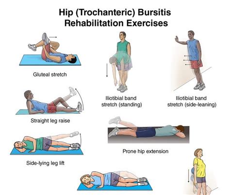 Trochanteric Bursitis Exercises Hip Bursitis Treatment Bursitis – NBKomputer