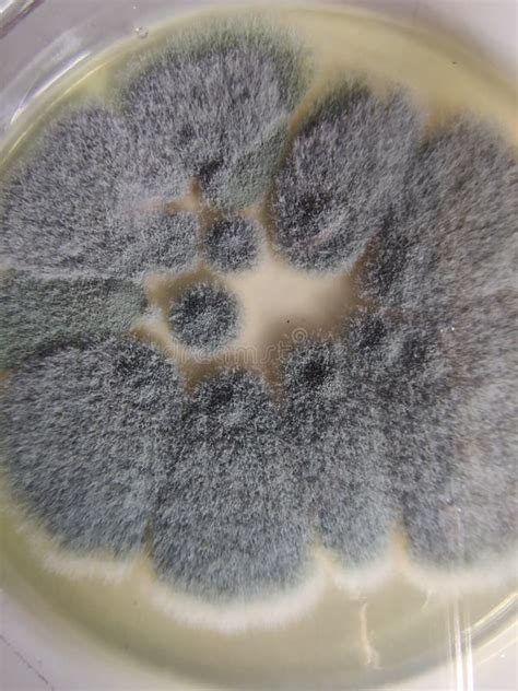 Aspergillus Fumigatus Colonies on Saboraud Dextrose Agar Medium Stock Image - Image of nature ...