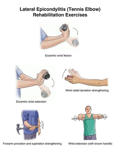 Upper Body Exercises Safe for Tennis Elbow - Senior Tennis Club