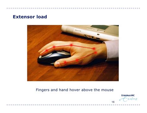 Comparison Of Ergonomic Mouse