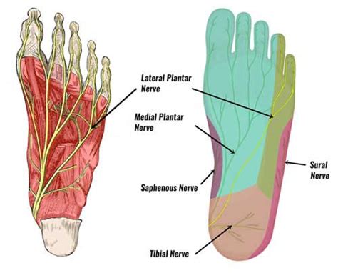 Lateral Plantar Nerve Entrapment Symptoms & Treatment