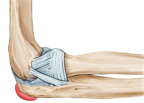 Olecranon bursitis