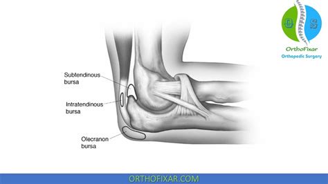 Elbow (Olecranon) Bursitis: Symptoms, Causes Treatment, 55% OFF