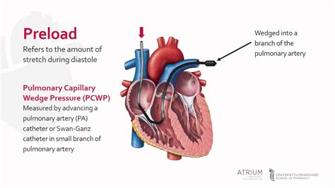 What Increases Preload In The Heart - cloudshareinfo