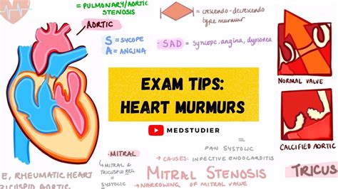 Heart Murmur Mitral Valve