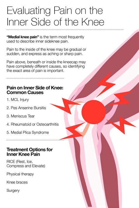 Types Of Knee Pain: Anterior, Posterior, Medial, Lateral, 55% OFF