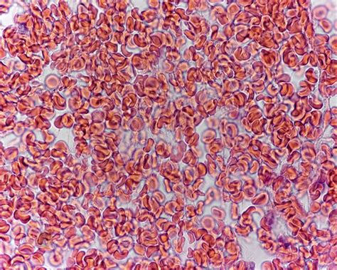 Red blood cells, light micrograph - Stock Image - C046/3636 - Science Photo Library