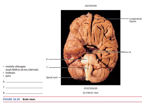 [Solved] SUPERIOR POSTERIOR ANTERIOR Superior colliculus Inferior colliculus... | Course Hero