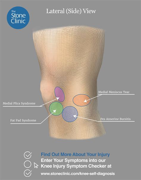 Knee Pain Symptom Checker [Online Knee Injury Self Diagnosis Tool]