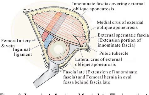 Femoral Hernia Anatomy