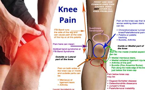 Knee Pain