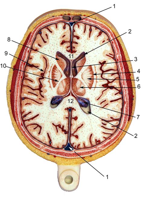 Axial View Of Brain