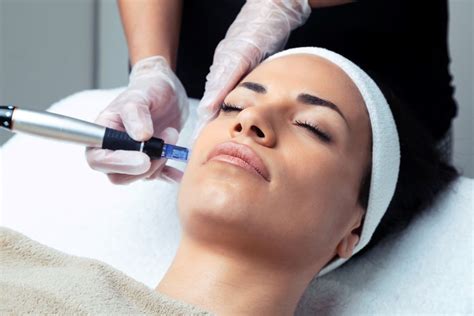 What Is a Vampire Facial? What You Need to Know About Microneedling With PRP (Platelet Rich ...