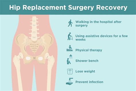 Hip Replacement Recovery: Tips from Doctors and Patients