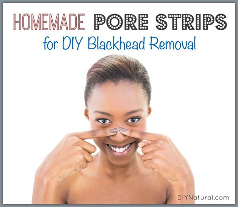 Natural Homemade Pore Strips For DIY Blackhead Removal