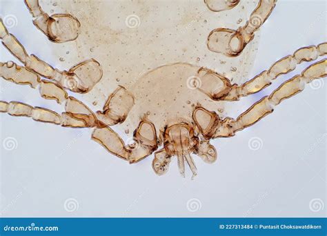 Dust Mite Under Light Microscope View Stock Photo - Image of hygiene, animal: 227313484